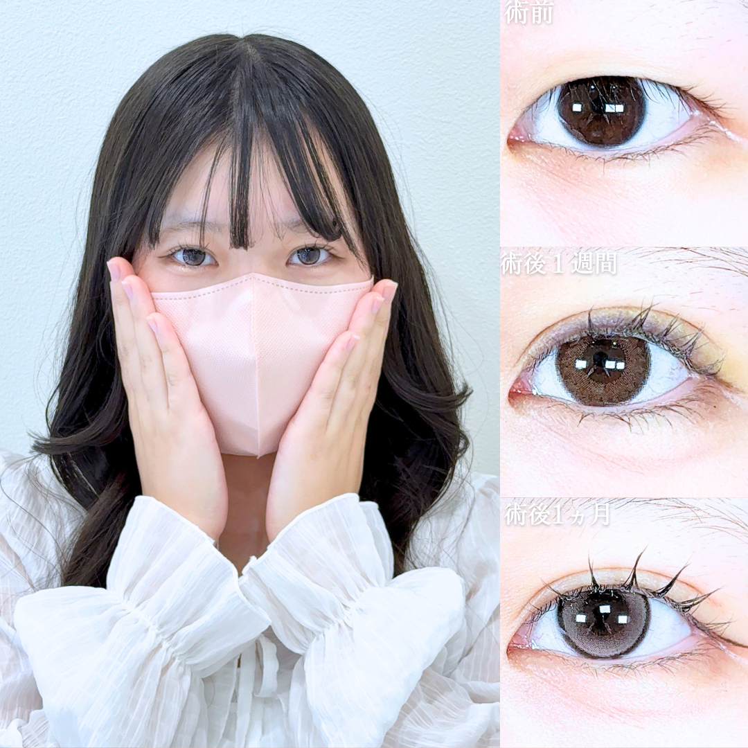 No.21076の症例写真