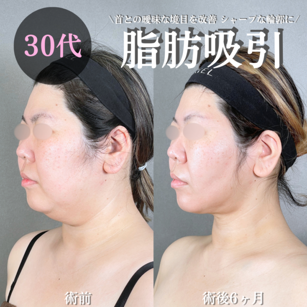 No.21082の症例写真