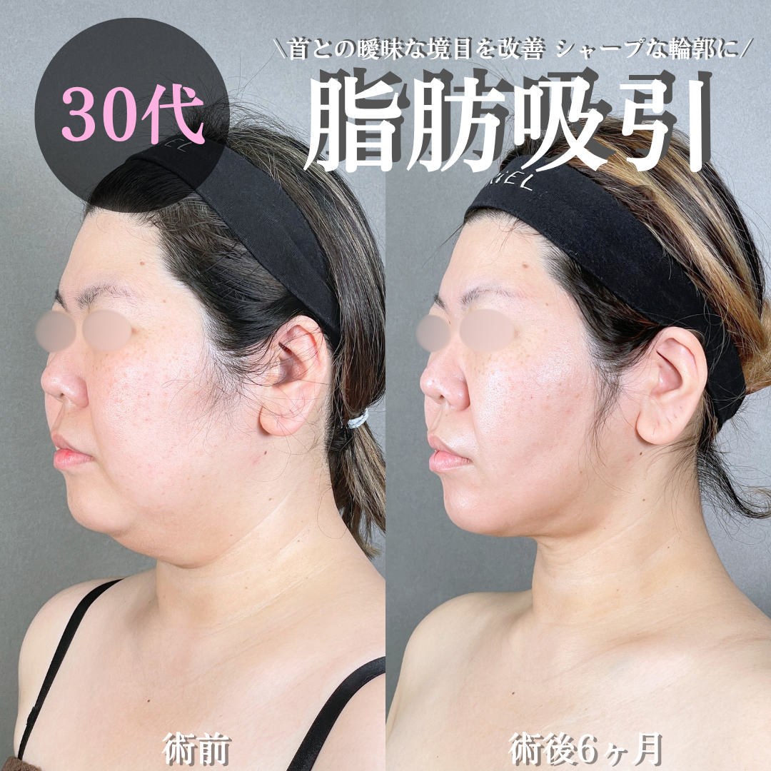 No.21082の症例写真