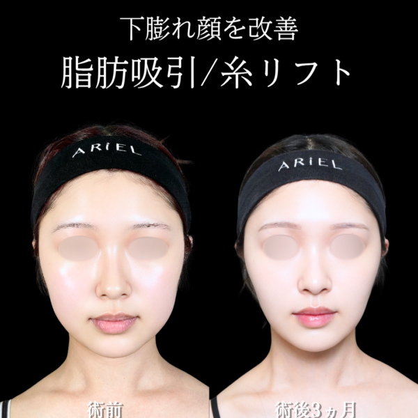 No.21090の症例写真