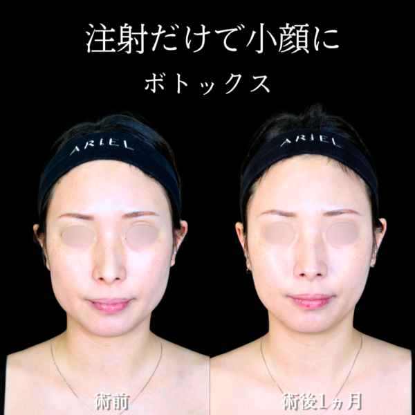 No.21089の症例写真