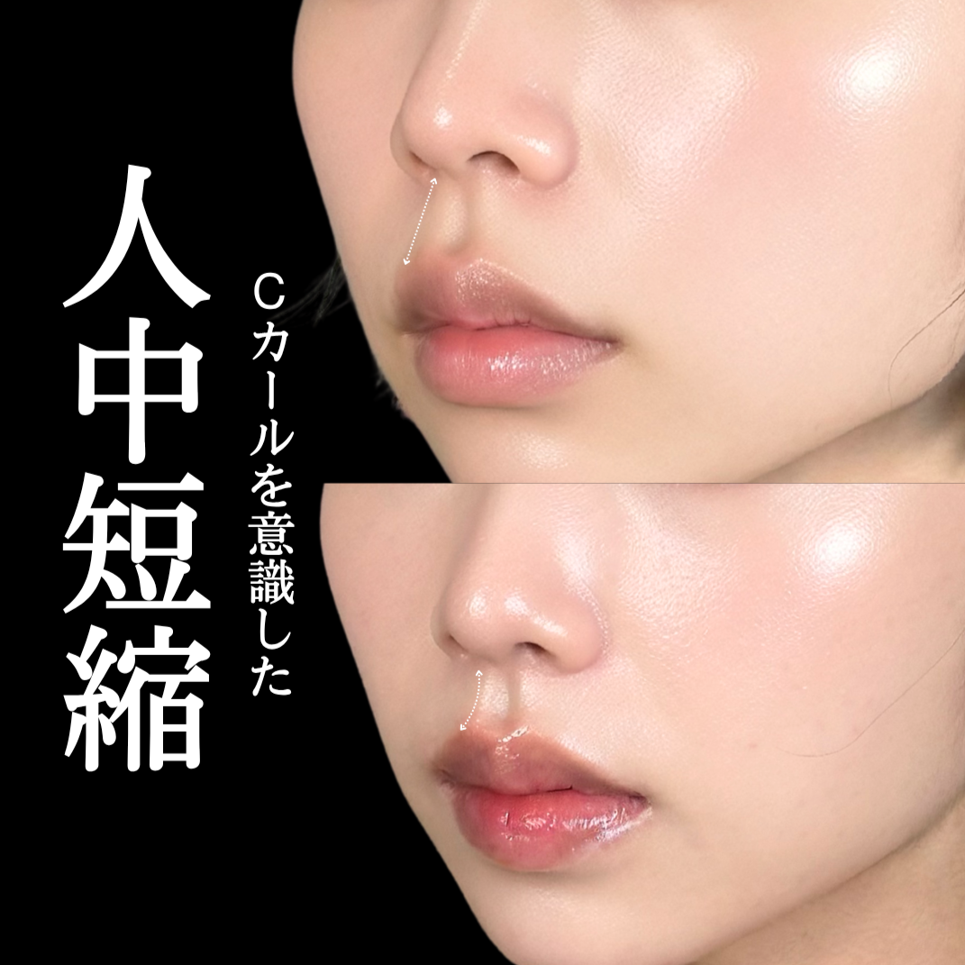 No.21110の症例写真