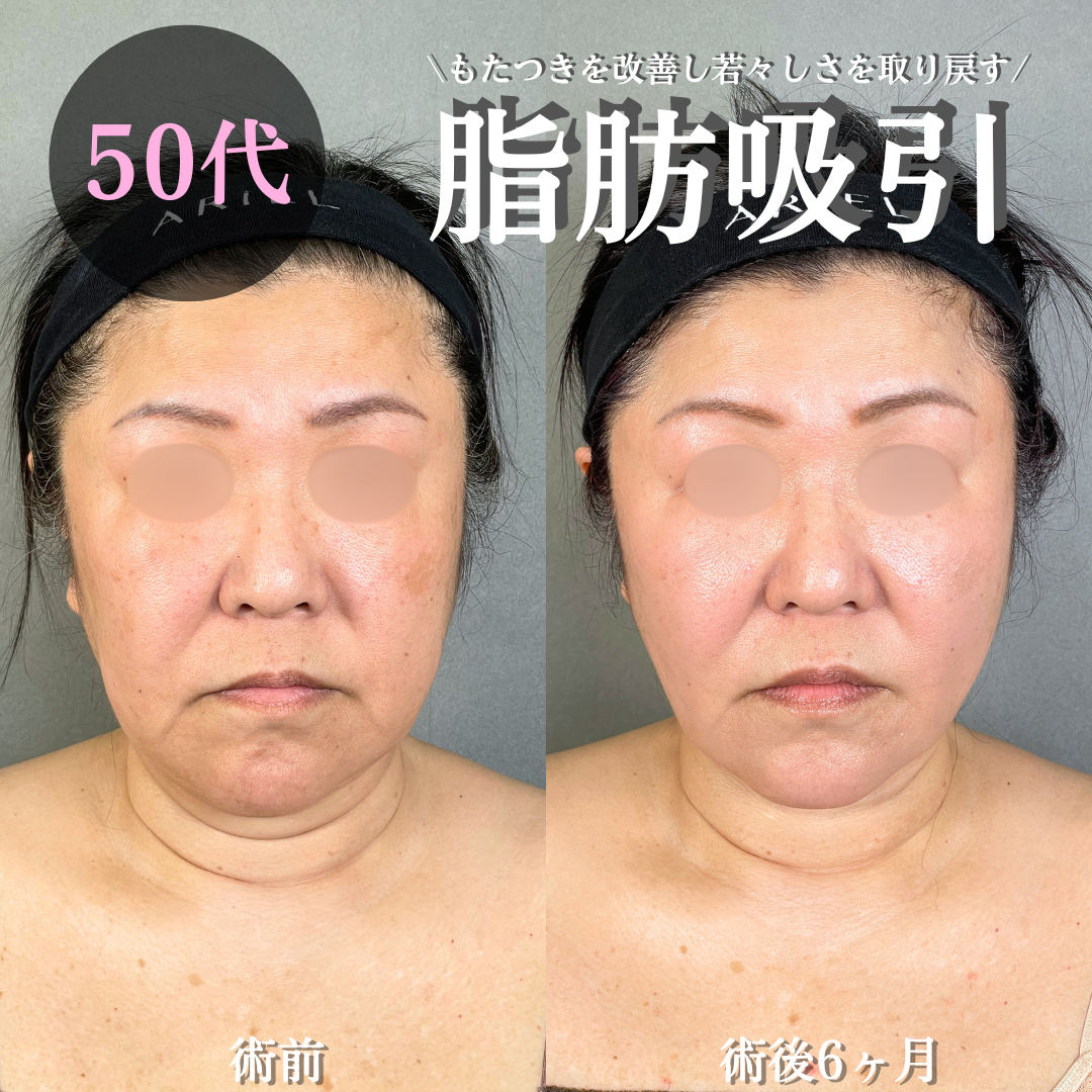 No.20679の症例写真