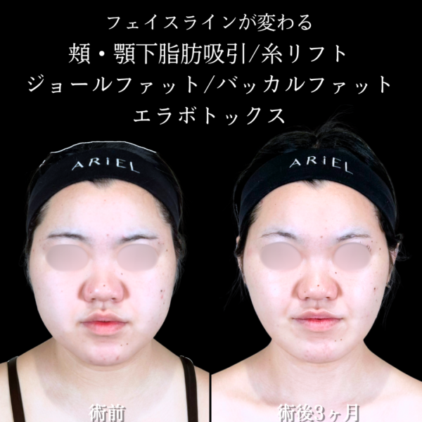 No.20713の症例写真