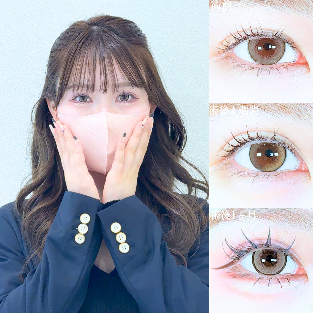 No.20719の症例写真