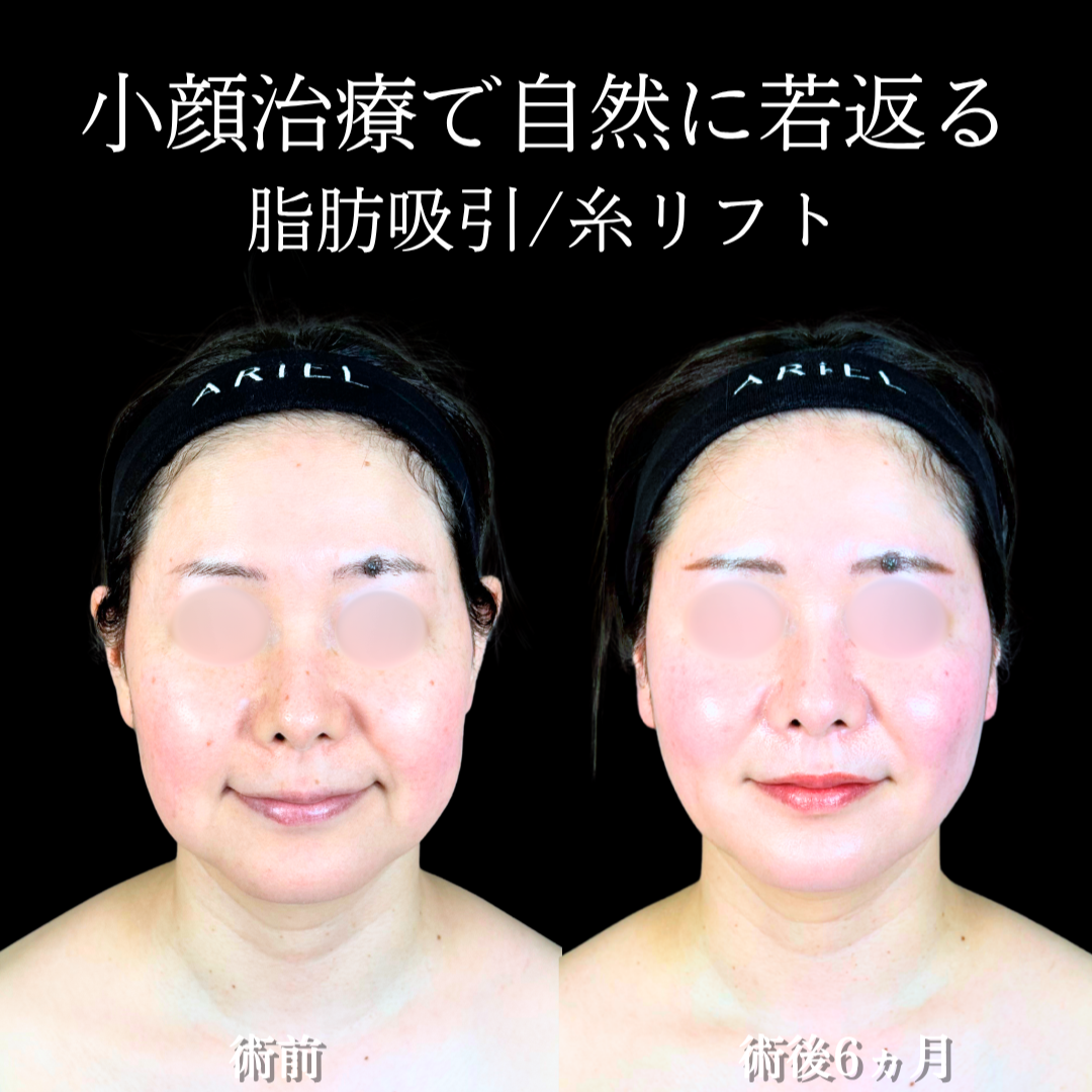 No.20726の症例写真