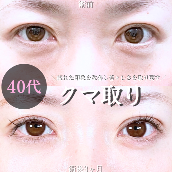 No.20733の症例写真