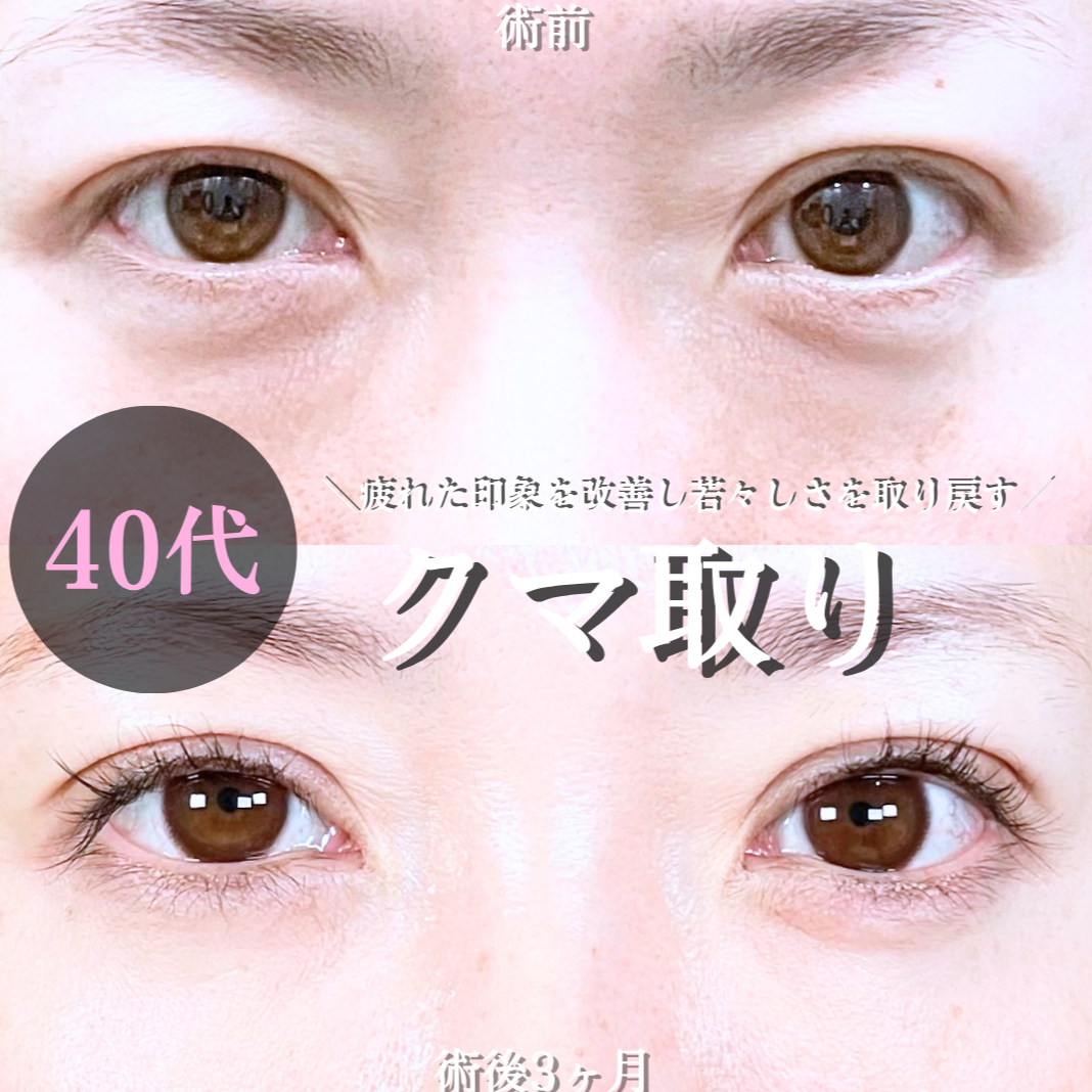 No.20733の症例写真