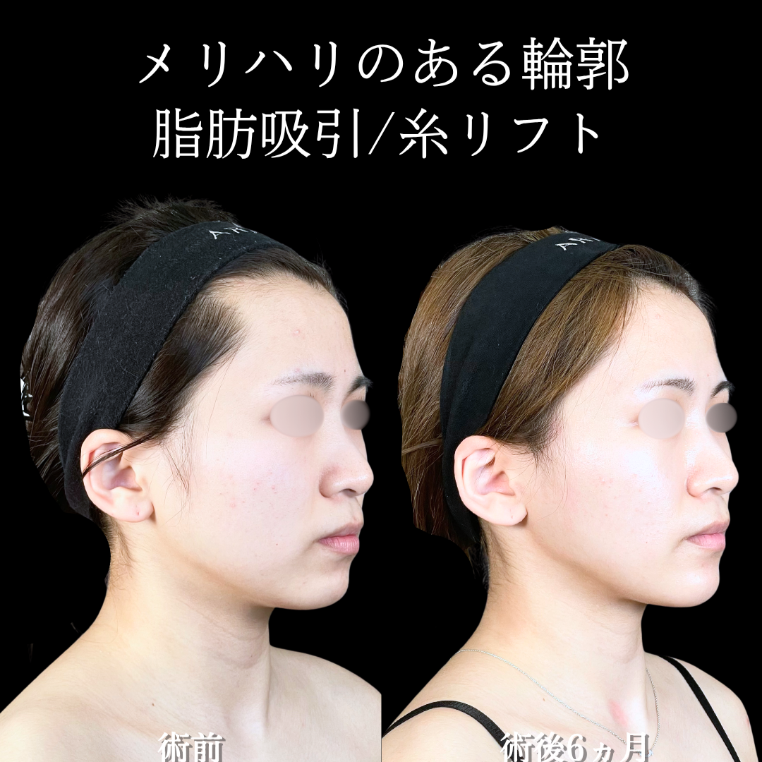 No.20742の症例写真