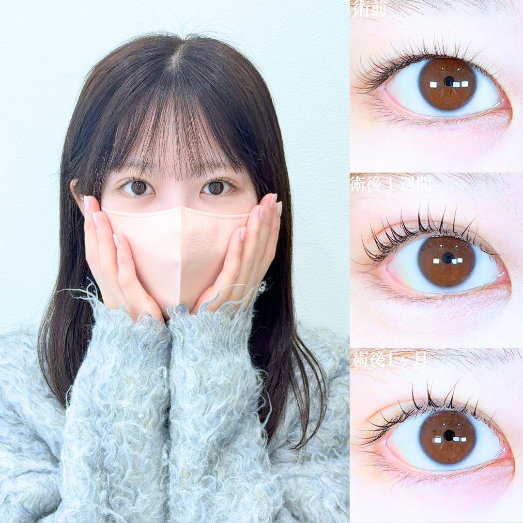 No.20767の症例写真