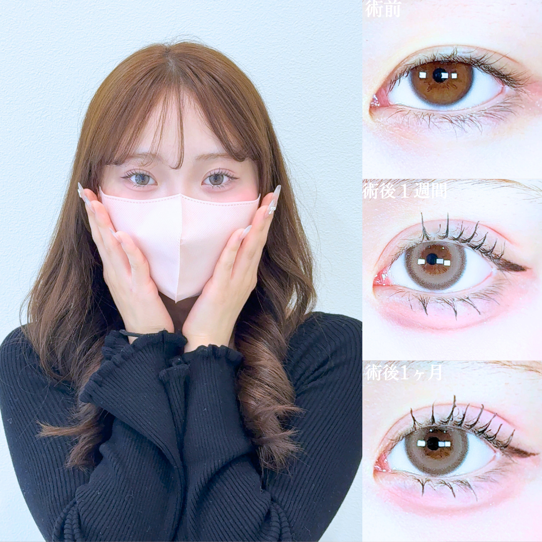 No.20616の症例写真