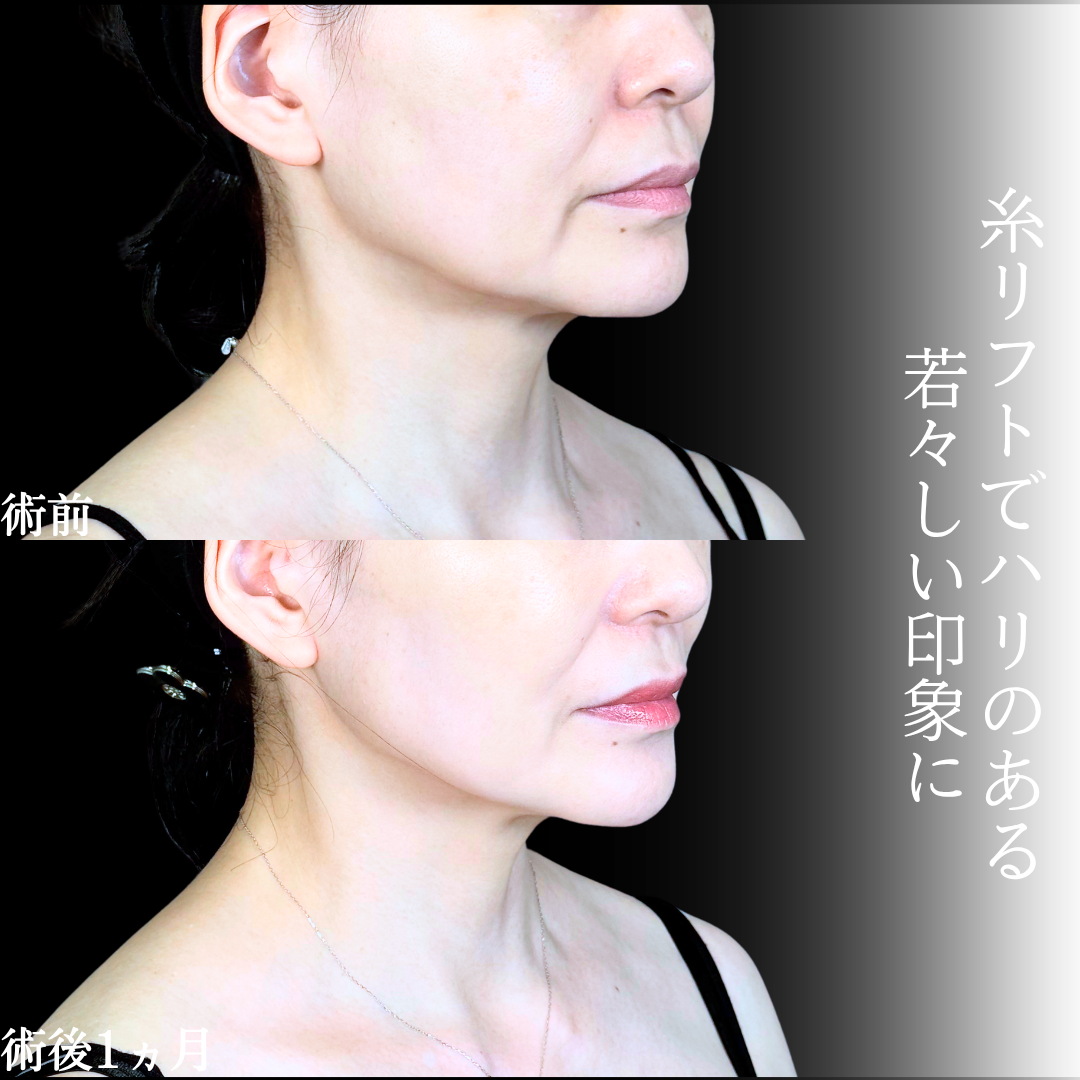 No.20656の症例写真1