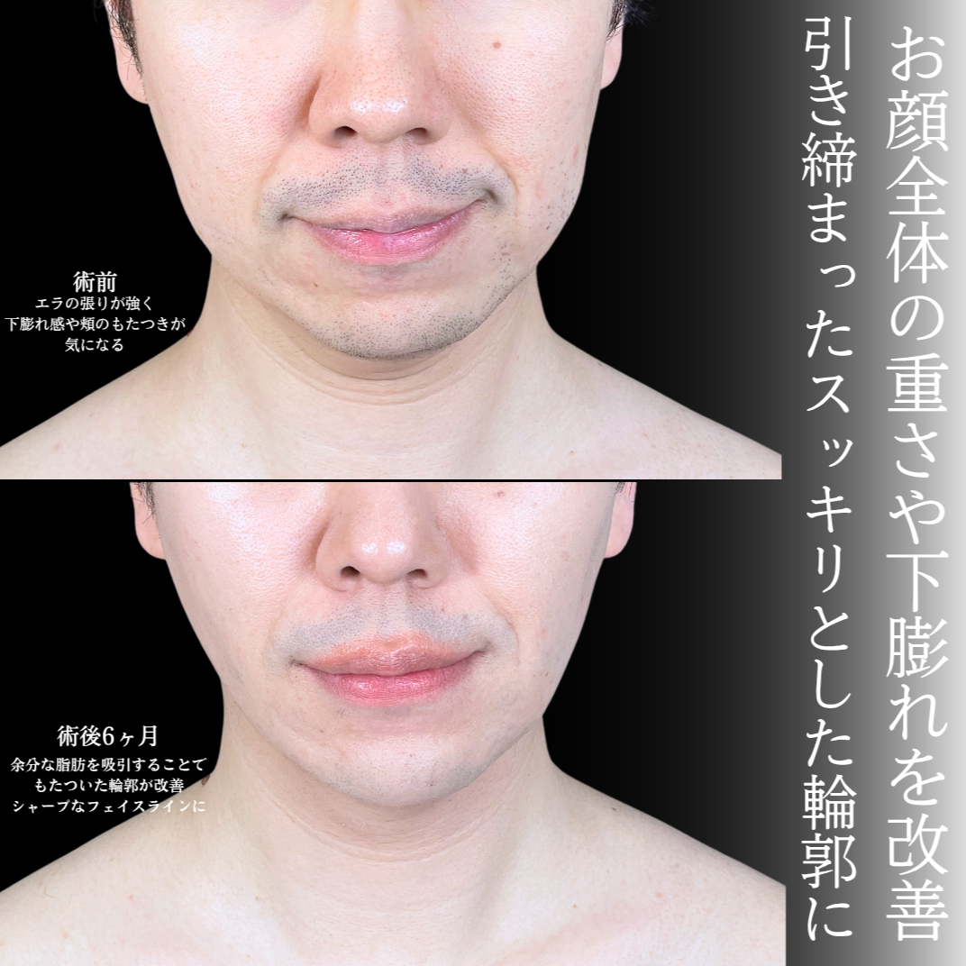 No.20775の症例写真1