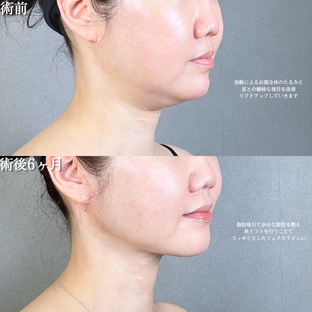 No.20783の症例写真1