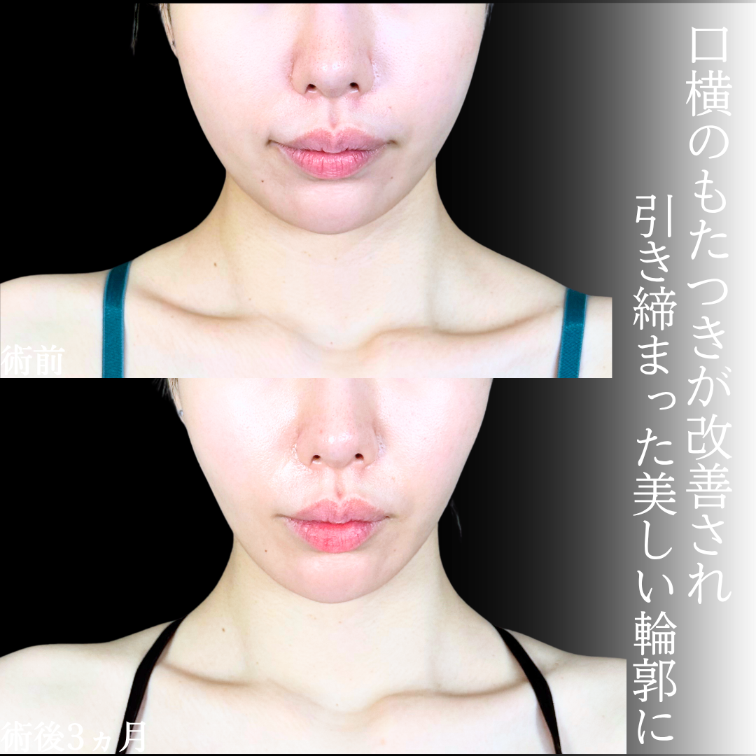 No.20805の症例写真1