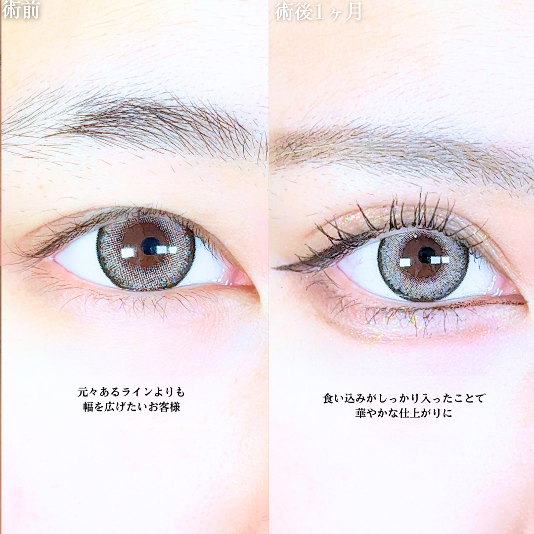 No.20820の症例写真1