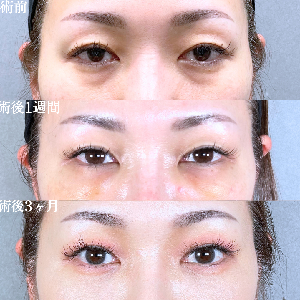 No.20833の症例写真1