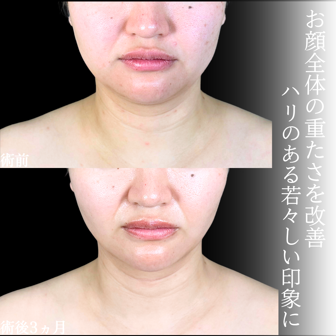 No.20840の症例写真1