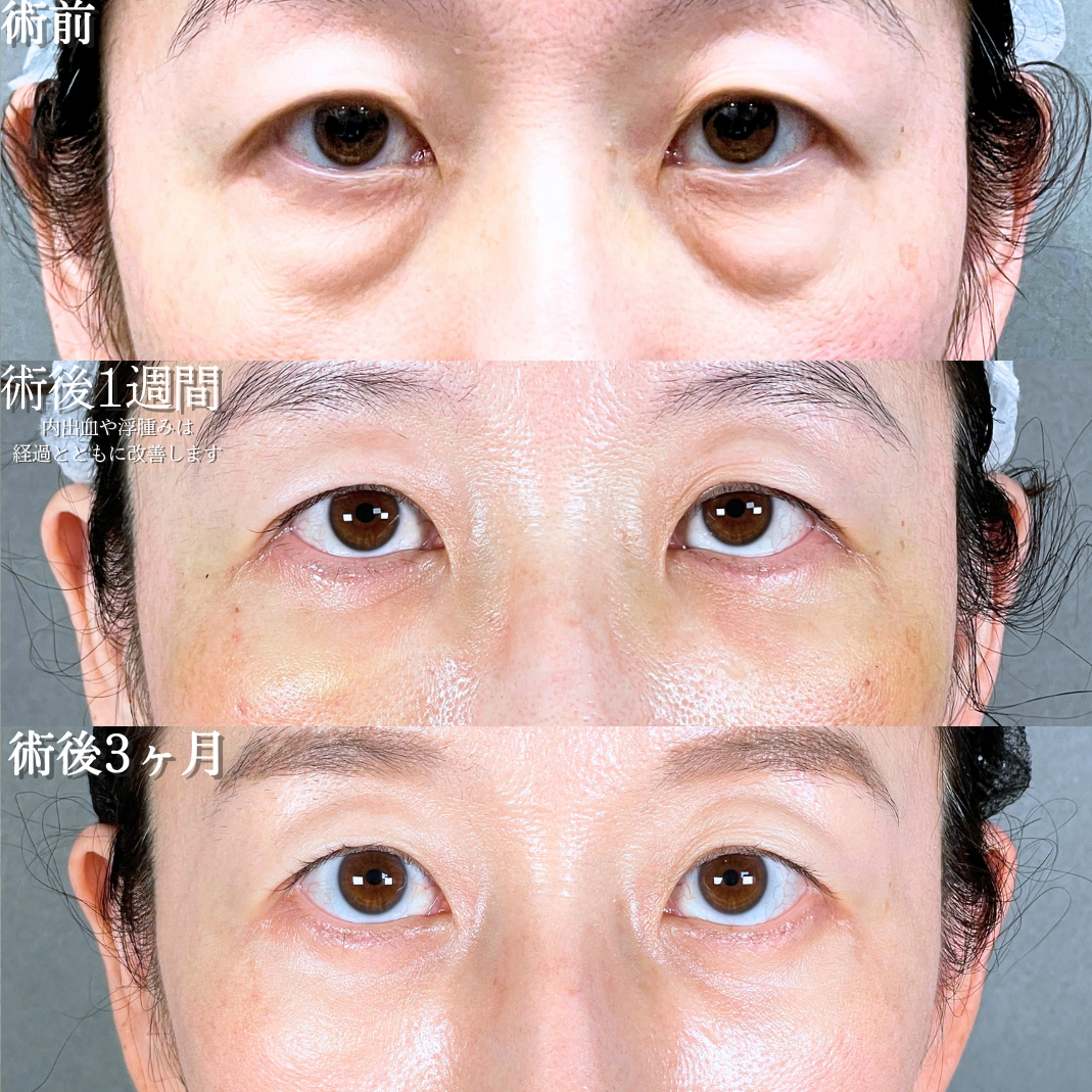 No.20856の症例写真1