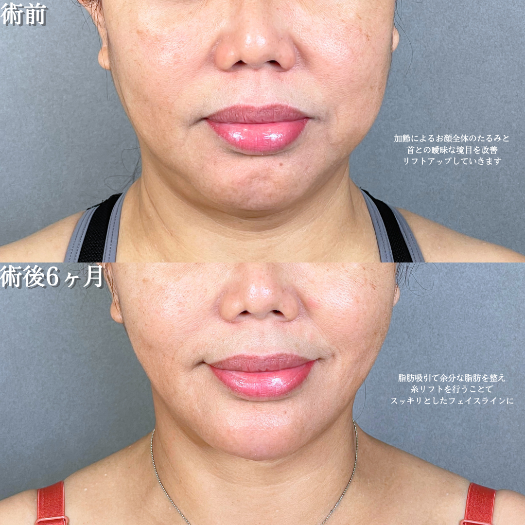 No.20876の症例写真1