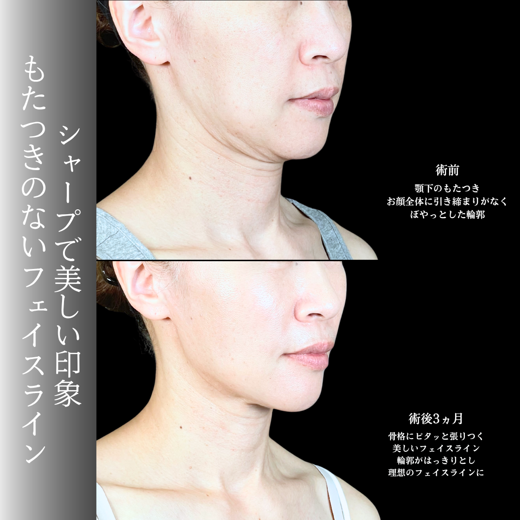 No.20669の症例写真1