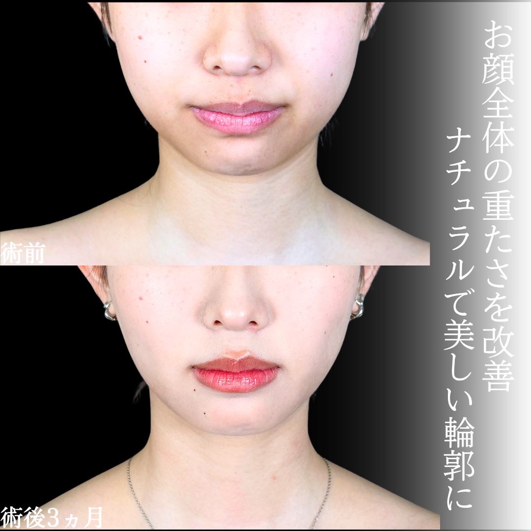 No.20894の症例写真1