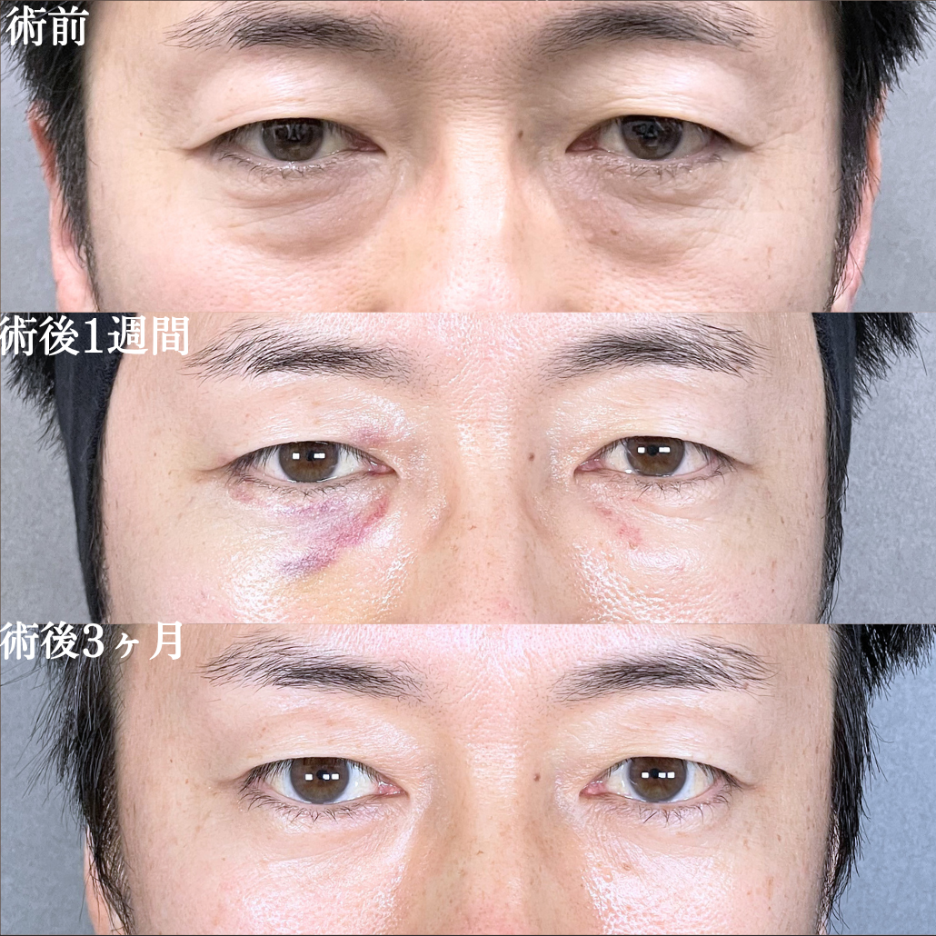 No.20916の症例写真1