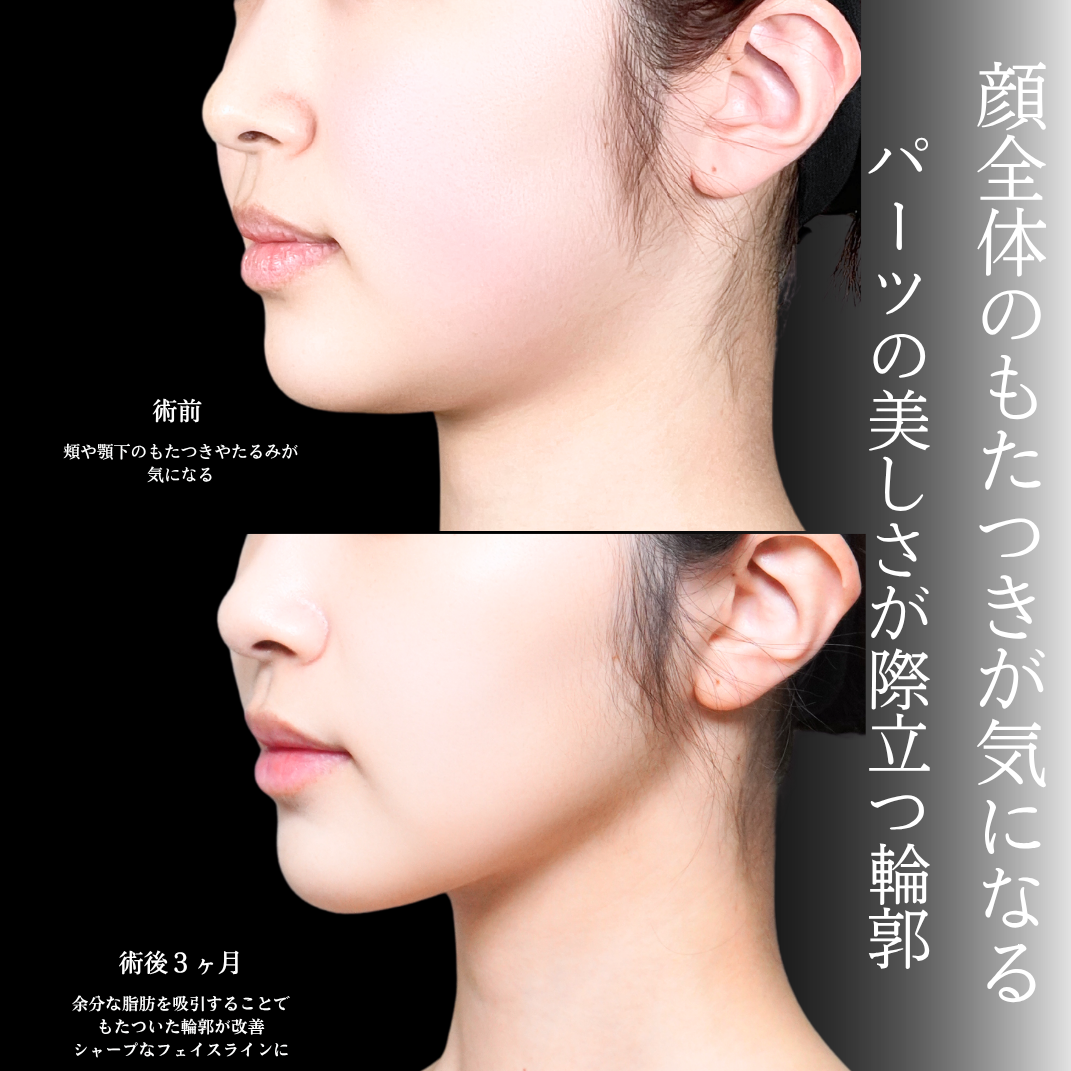 No.21006の症例写真2