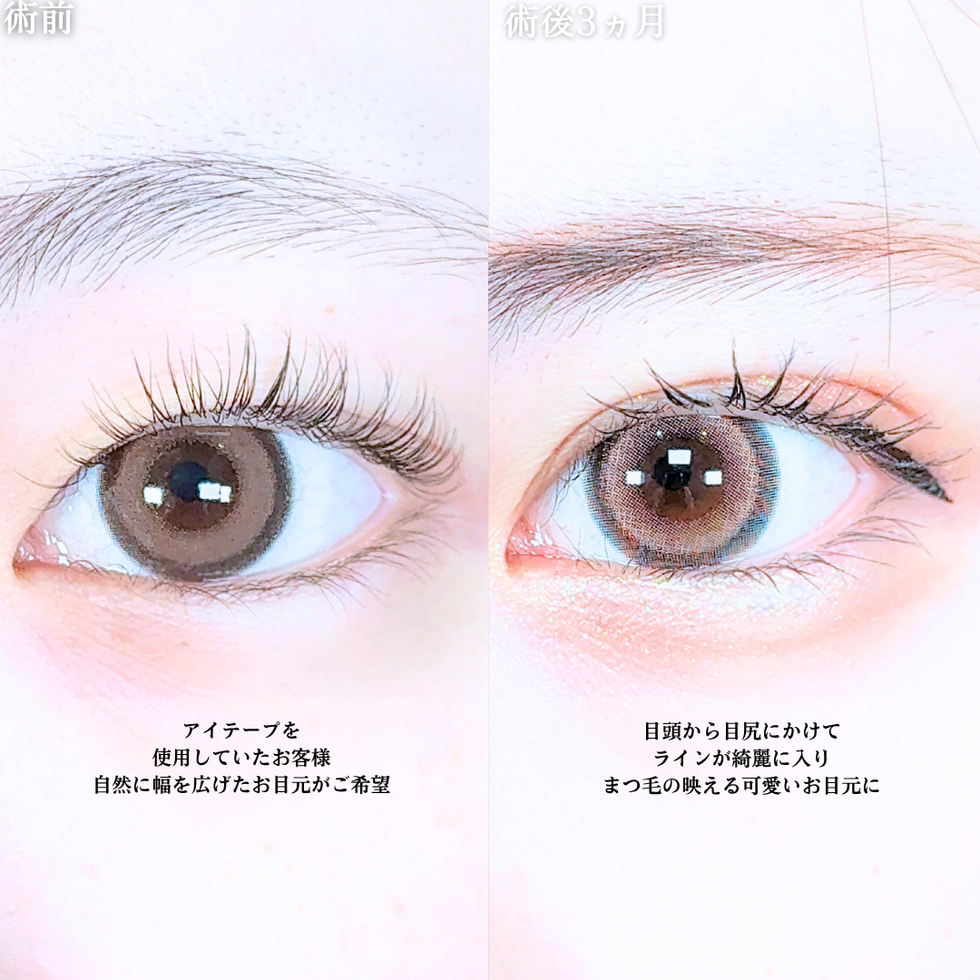 No.21021の症例写真1