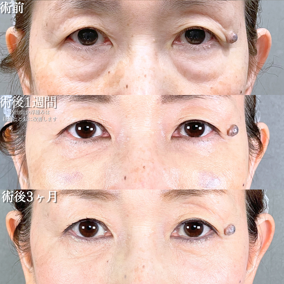 No.21027の症例写真1