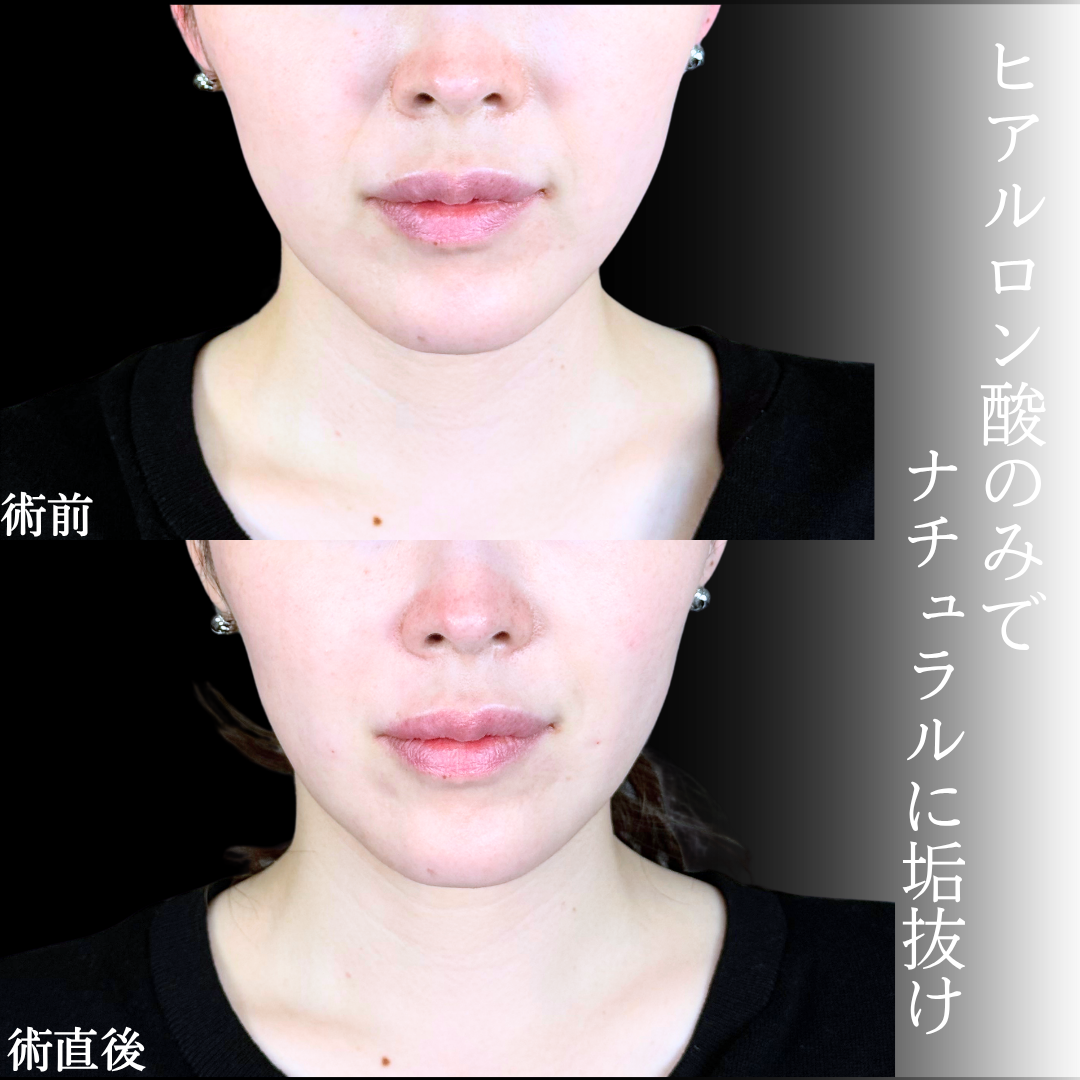 No.21034の症例写真1