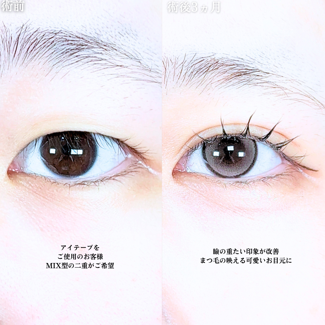 No.21076の症例写真1