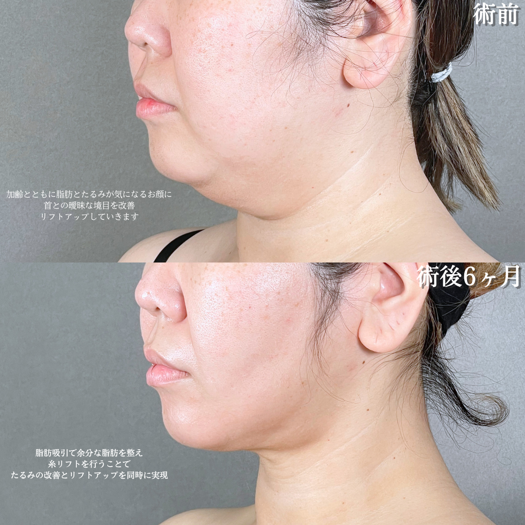 No.21082の症例写真1