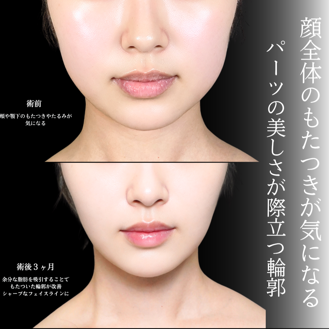 No.21090の症例写真1