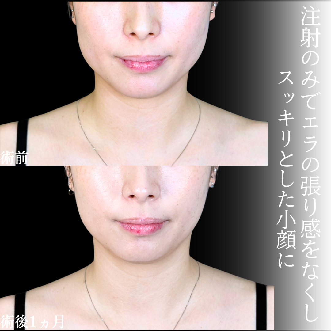 No.21089の症例写真1