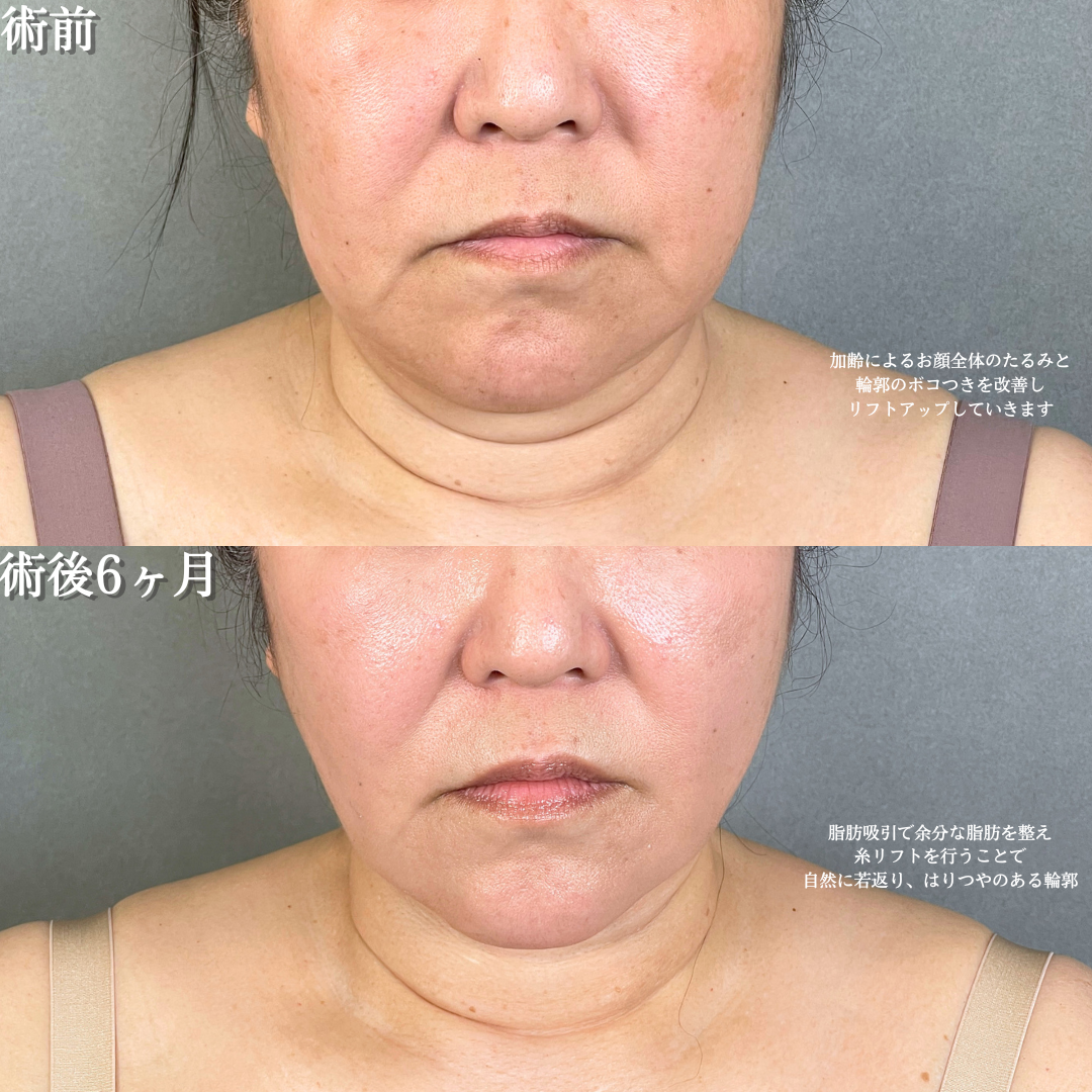 No.20679の症例写真1