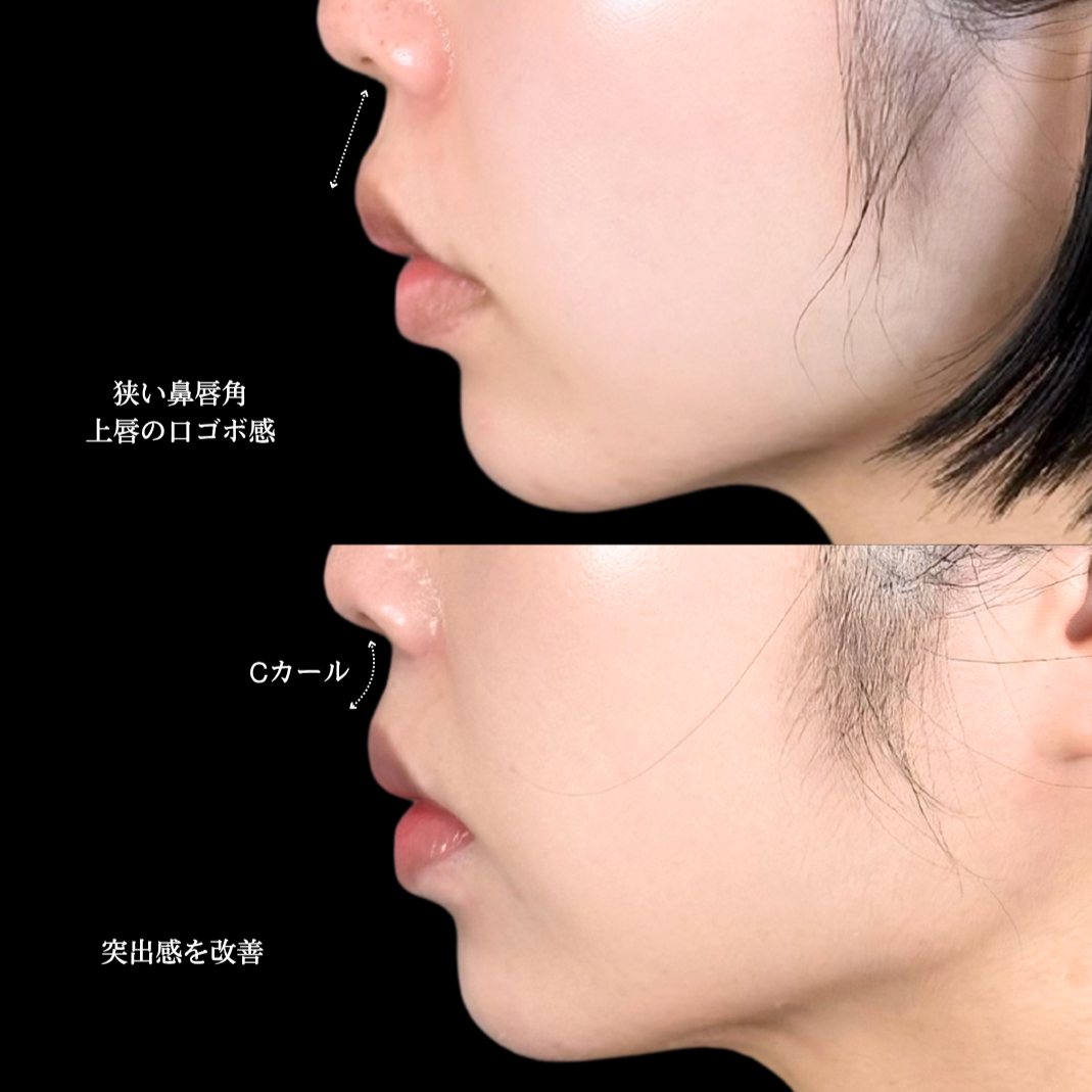 No.21110の症例写真1