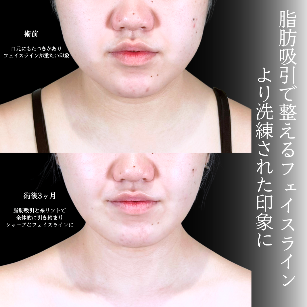 No.20713の症例写真1