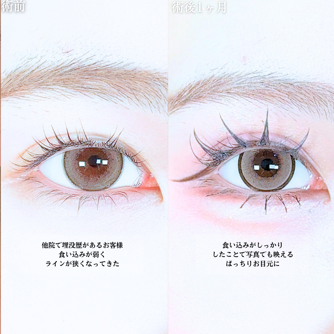 No.20719の症例写真1