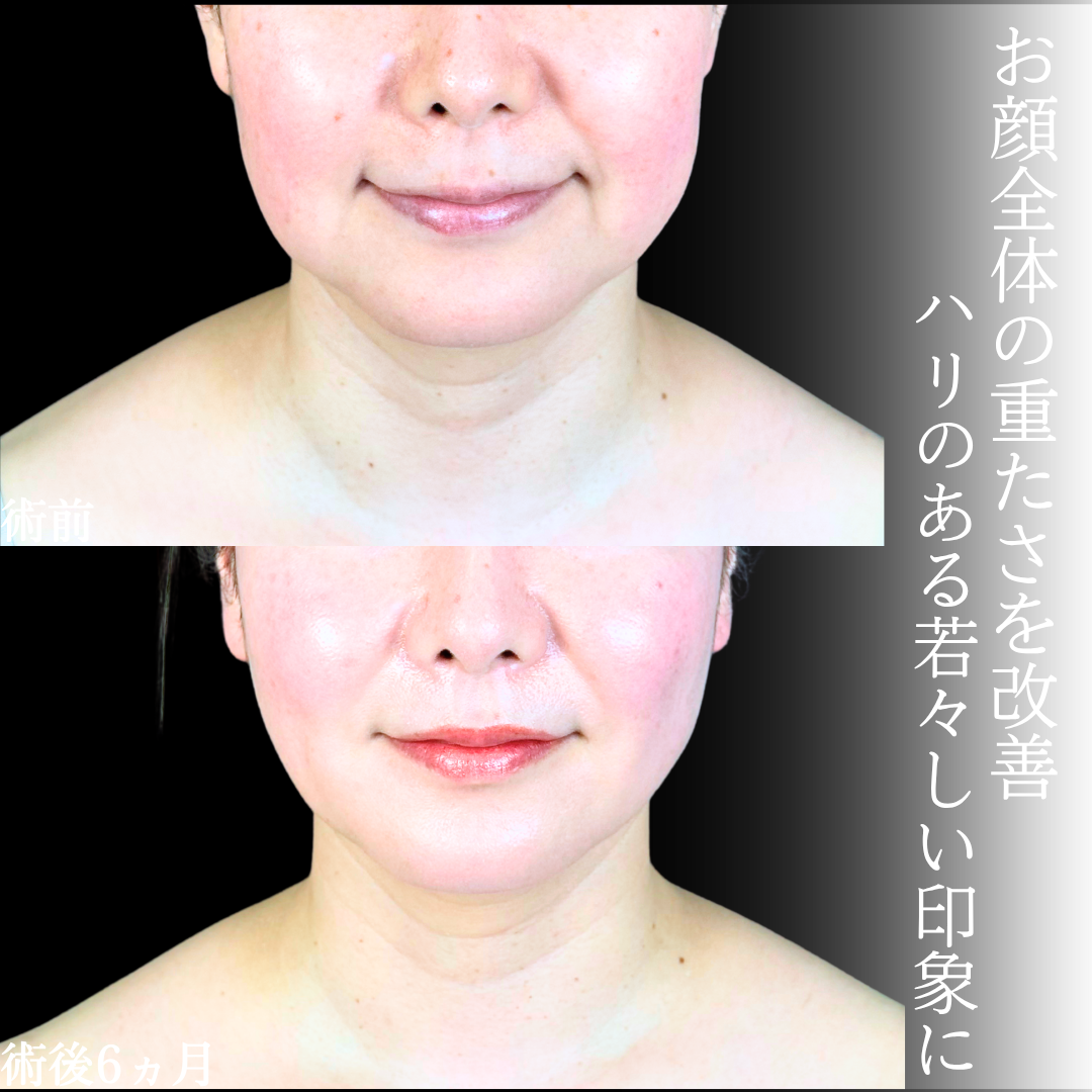 No.20726の症例写真1