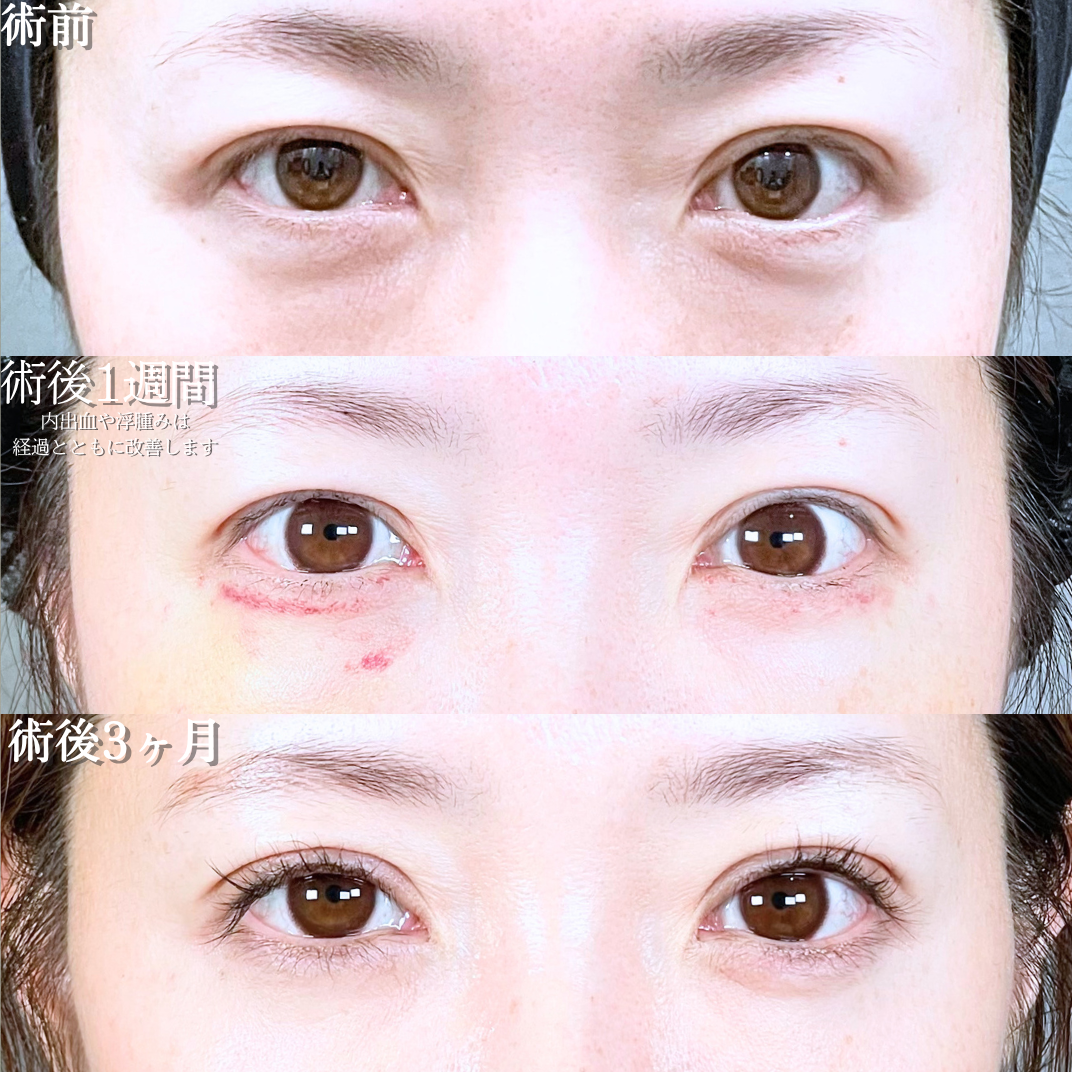 No.20733の症例写真1