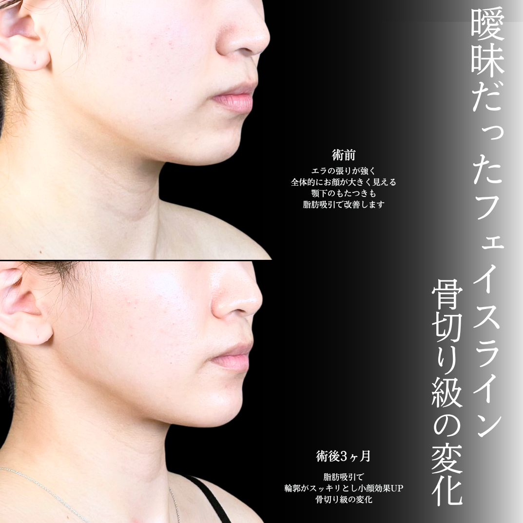 No.20742の症例写真1