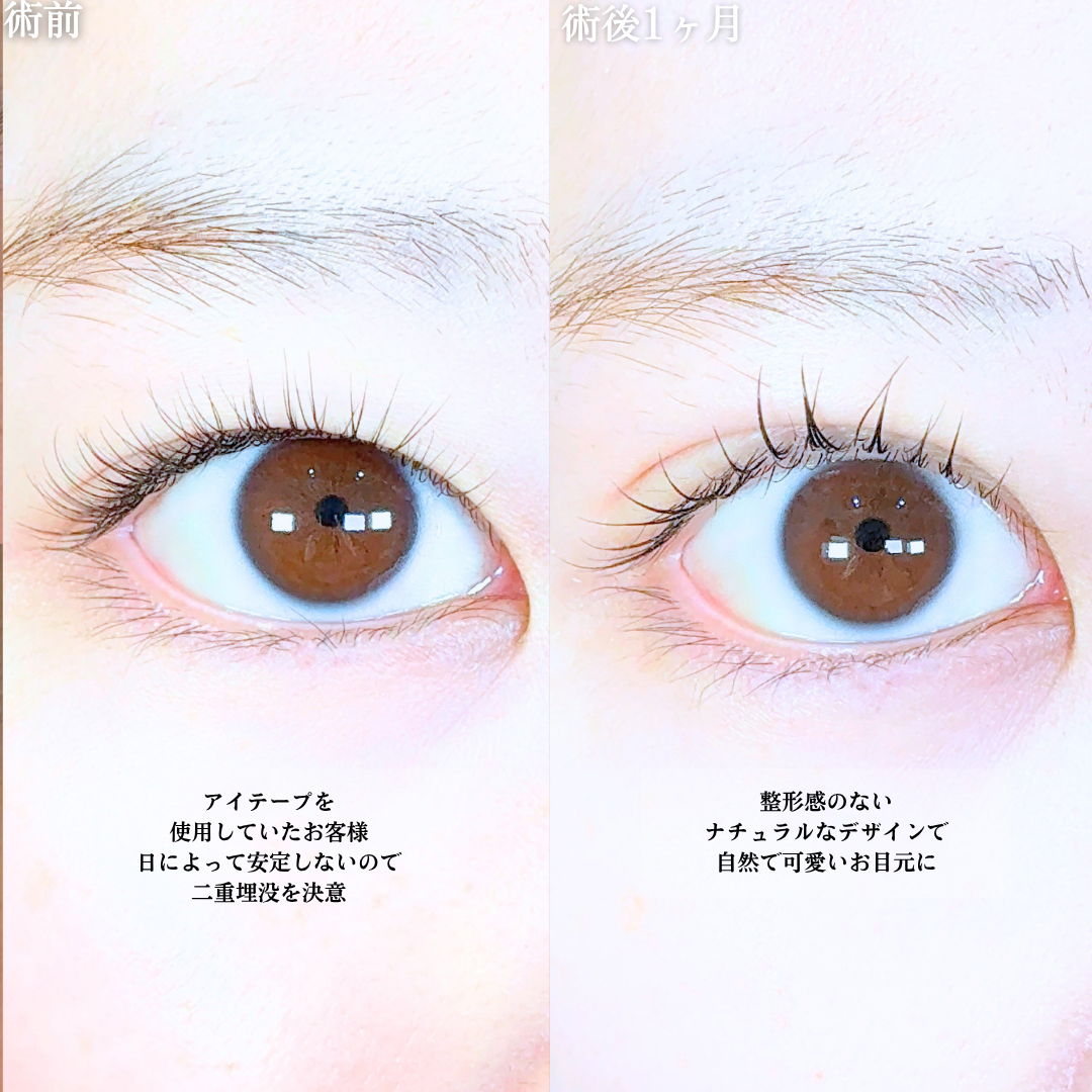 No.20767の症例写真1