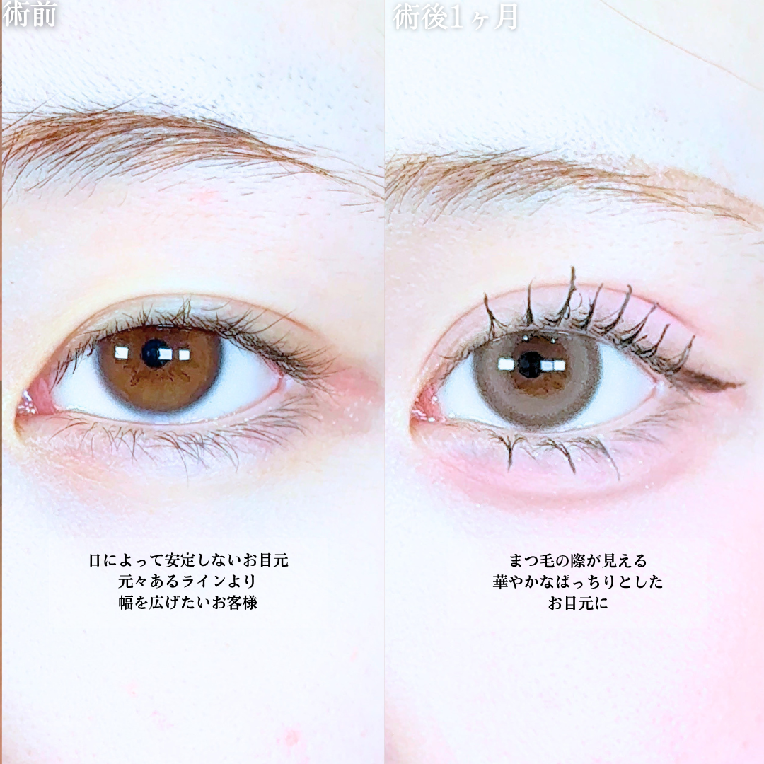 No.20616の症例写真1