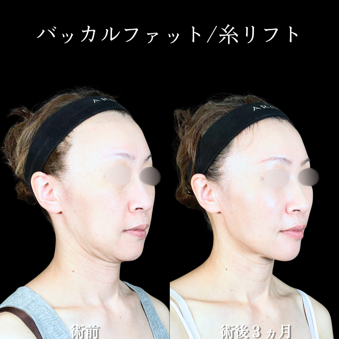 No.20669の症例写真2