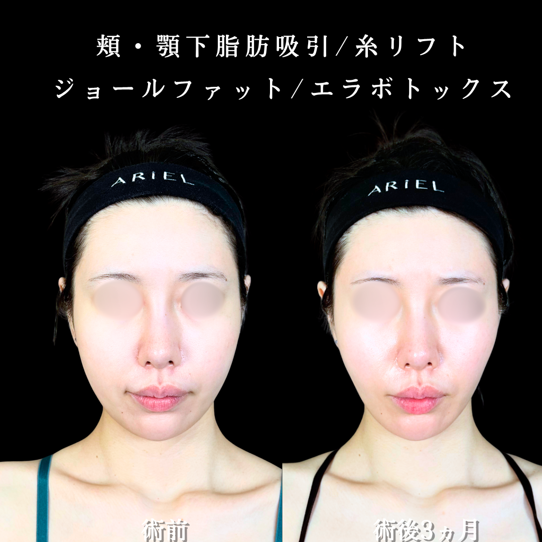 No.20805の症例写真2