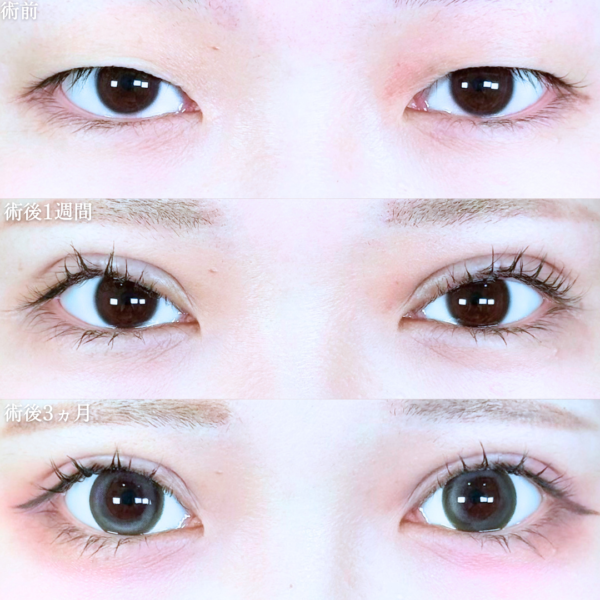 No.20812の症例写真