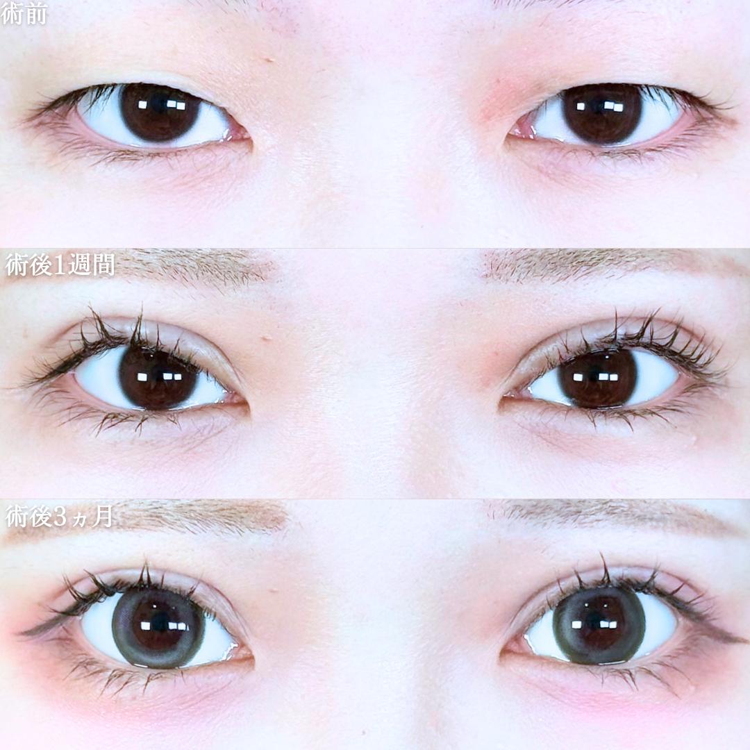 No.20812の症例写真