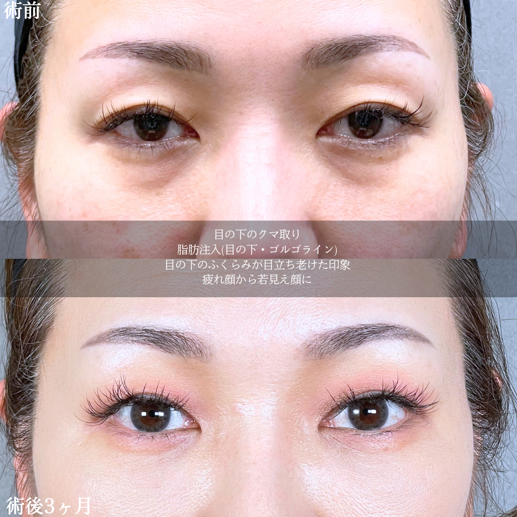 No.20833の症例写真2