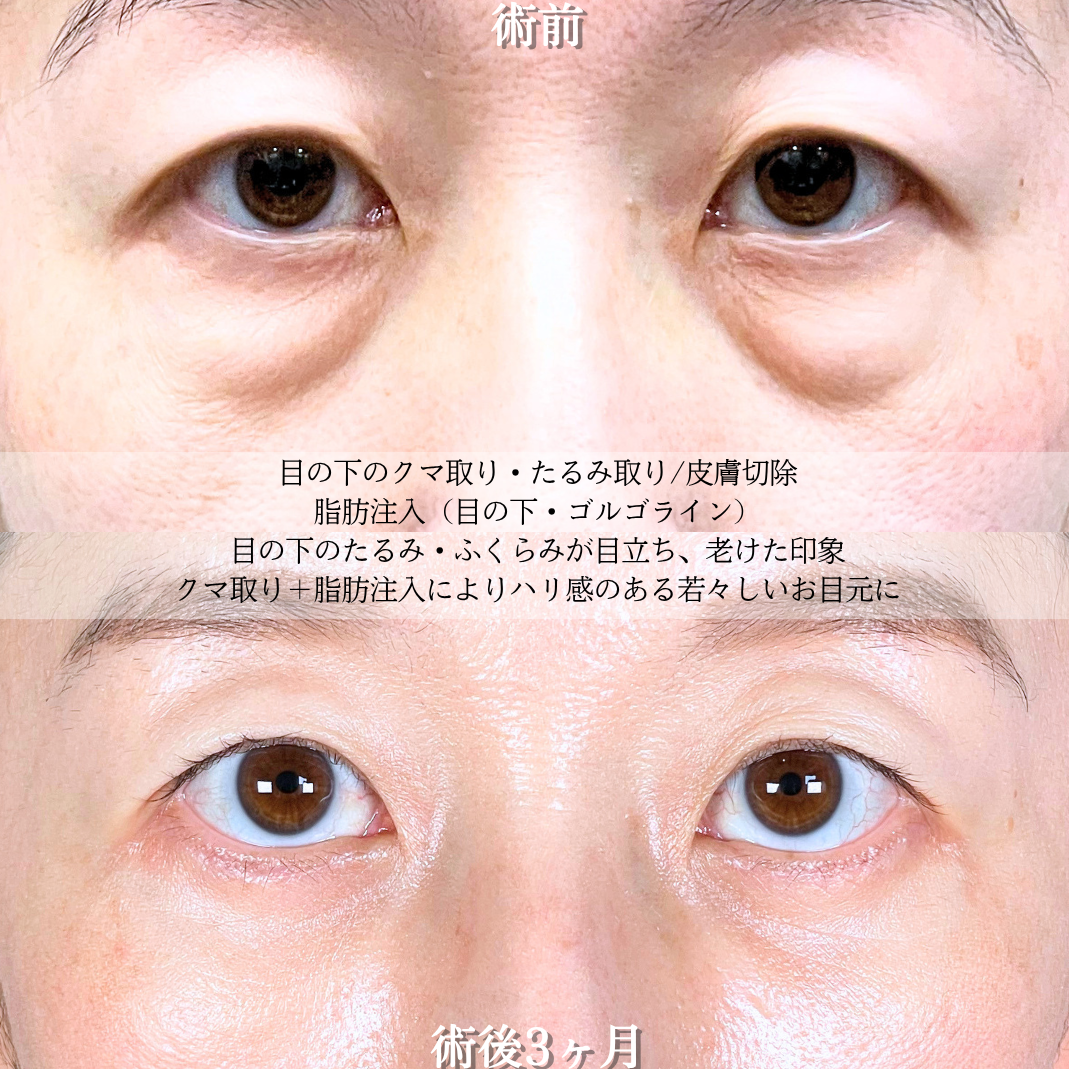 No.20856の症例写真2